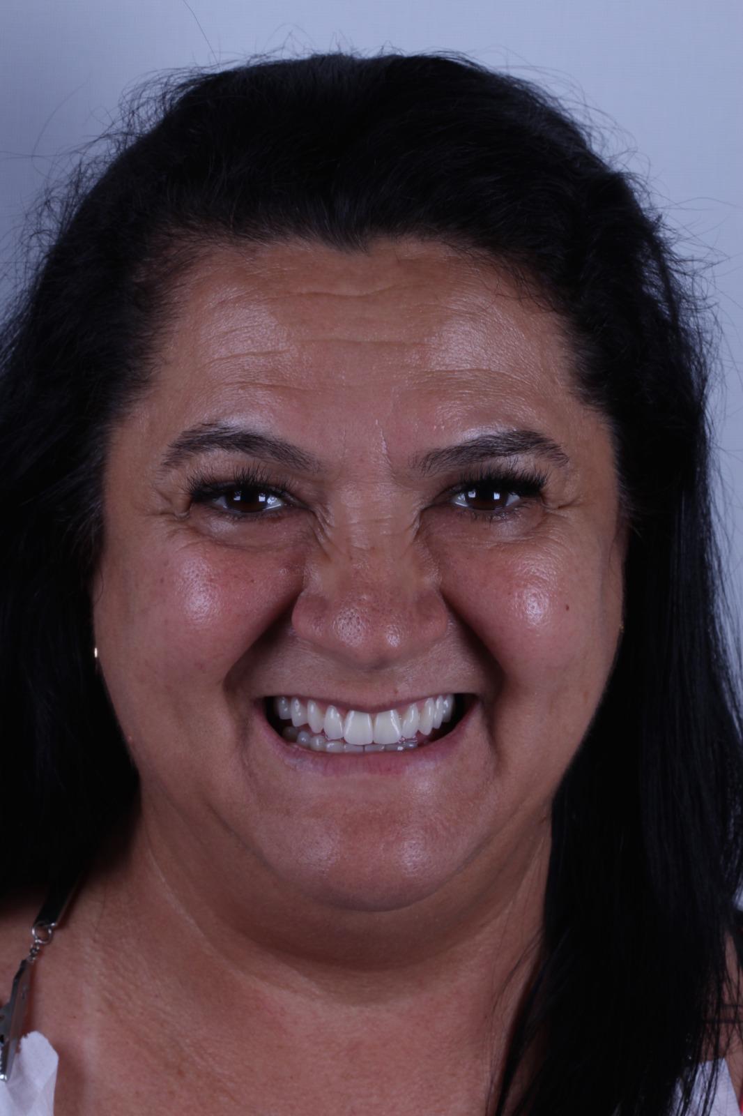 Senhora muito feliz depois do tratamento odontologico com um belo sorriso.