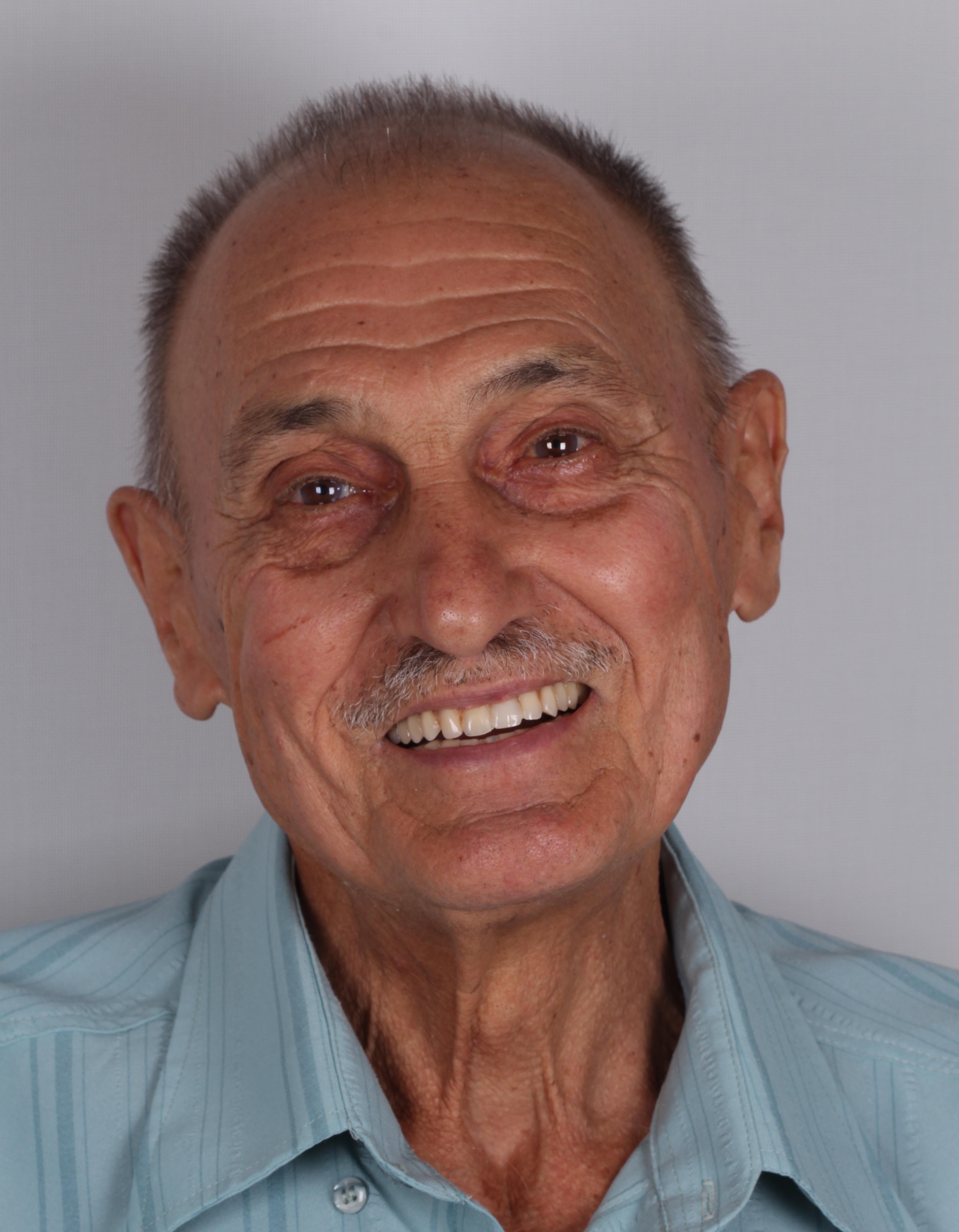 Senhor antes do tratamento odontologico.