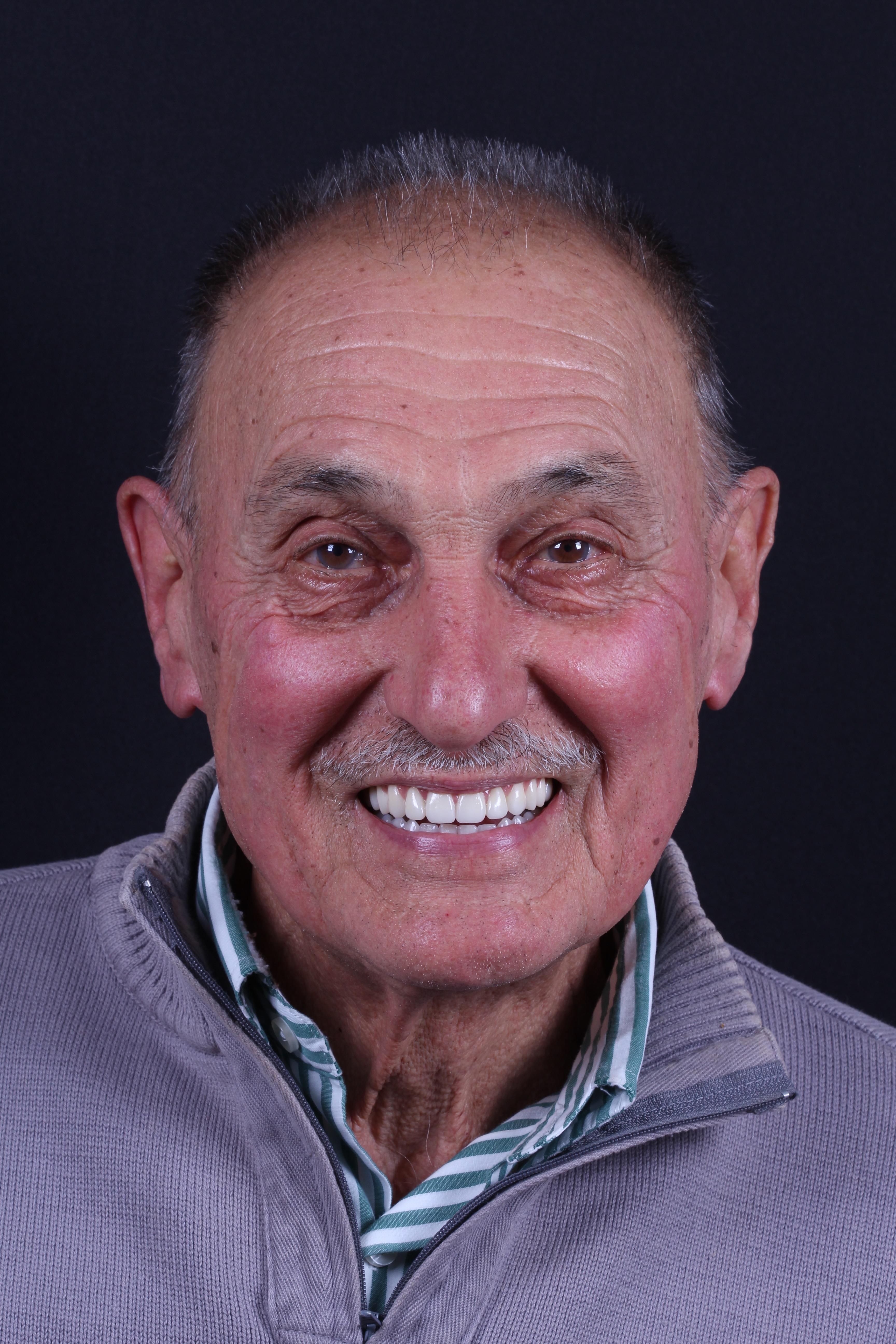Senhor muito feliz depois do tratamento odontologico com um belo sorriso.